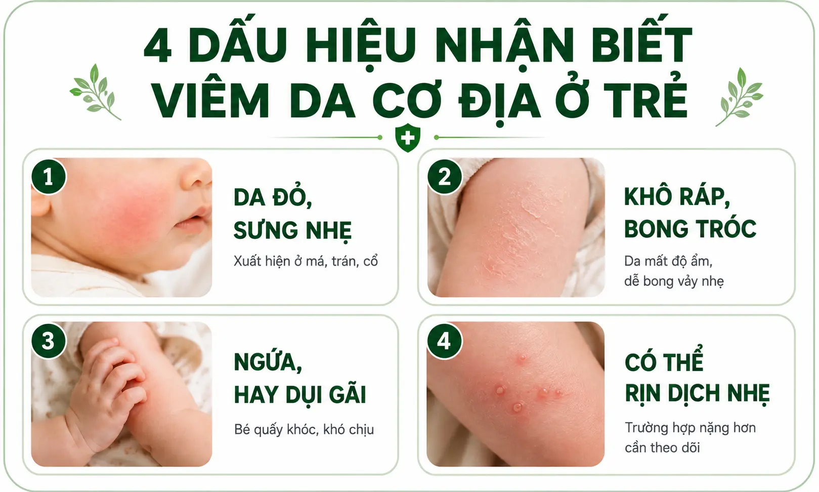 Dấu hiệu nhận biết viêm da cơ địa ở trẻ nhỏ