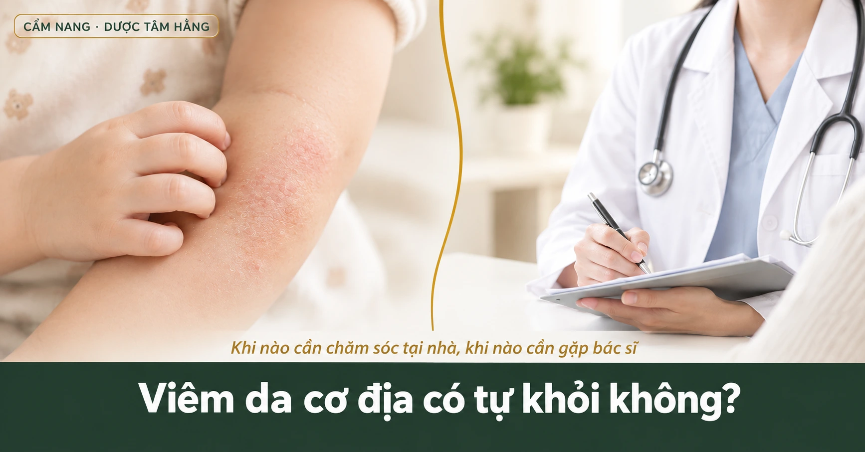 Viêm da cơ địa tự khỏi được không ?